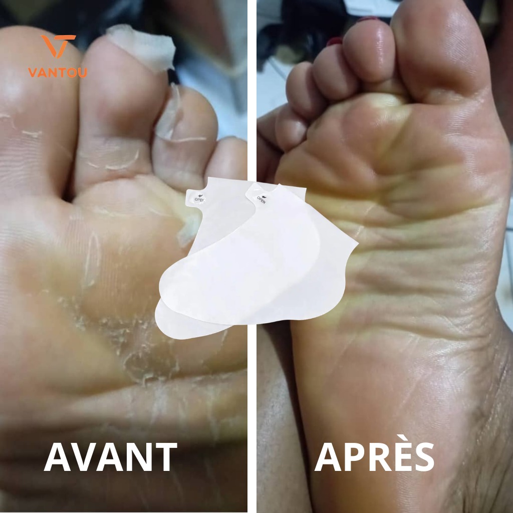 chausettes peeling ( pieds doux ) chausettes peeling ( pieds doux )