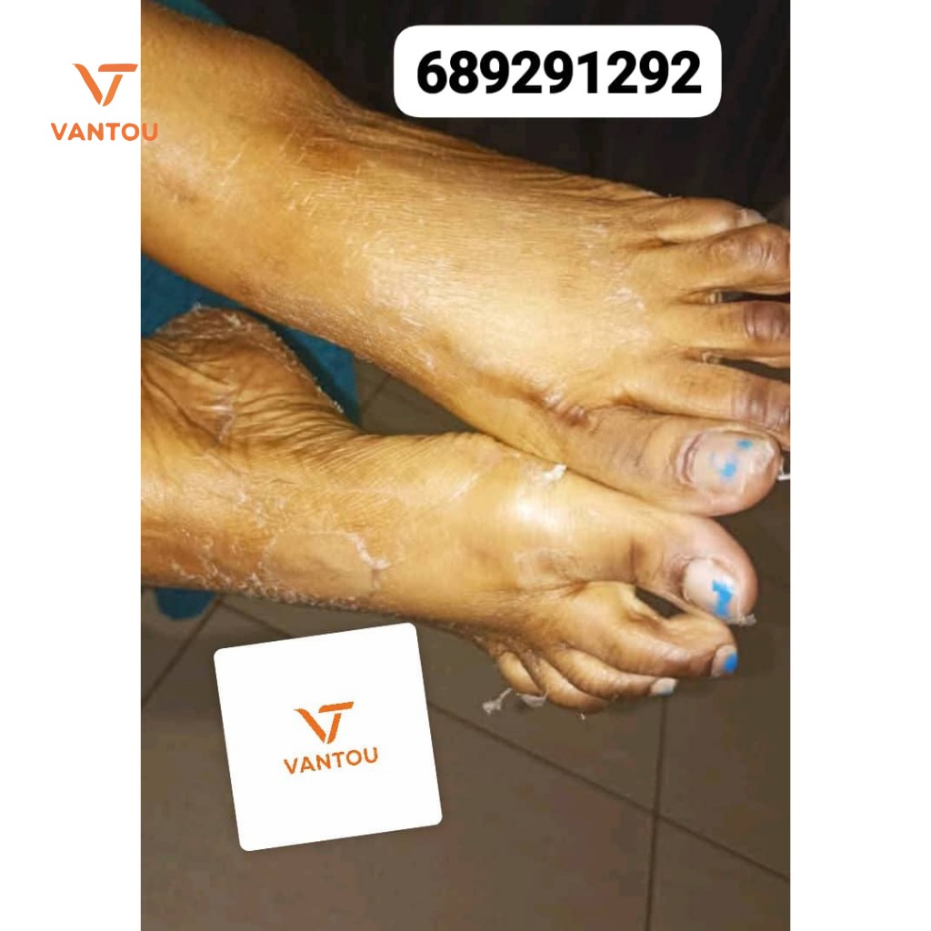 chausettes peeling ( pieds doux ) chausettes peeling ( pieds doux )