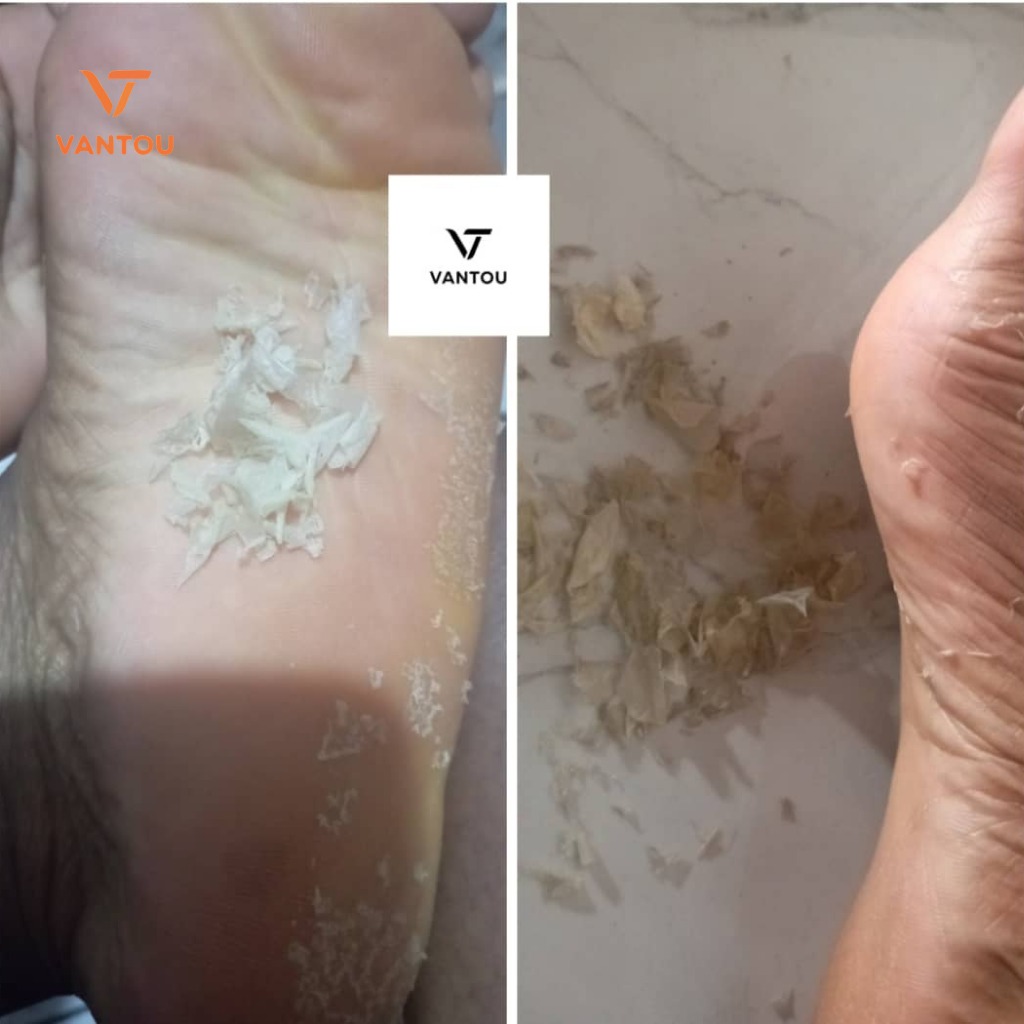 chausettes peeling ( pieds doux ) chausettes peeling ( pieds doux )