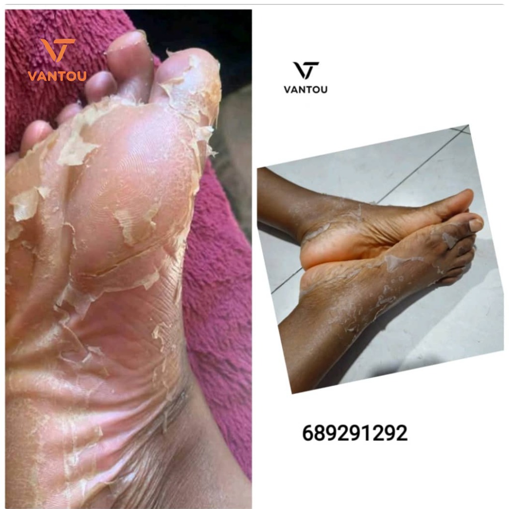 chausettes peeling ( pieds doux ) chausettes peeling ( pieds doux )